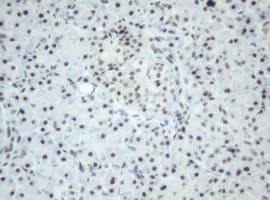 SF3A1 / SF3A120 Antibody (clone OTI4D8)