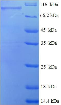 Human EHHADH / Enoyl-Coa Hydratase Protein (Recombinant His-SUMO)