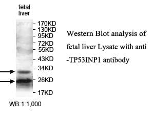 SIP / TP53INP1 Antibody (N-Terminus)