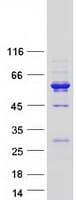 Human CCDC114 Protein (Recombinant Myc-DDK (Flag))