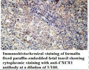CXCR1 Antibody (N-Terminus)