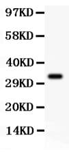 CD274 / B7-H1 / PD-L1 Antibody (aa45-290)