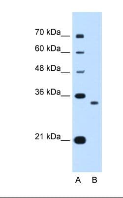 NDRG2 Antibody (C-Terminus, FITC)