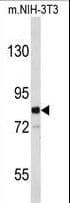 EVI5 Antibody (aa191-220)