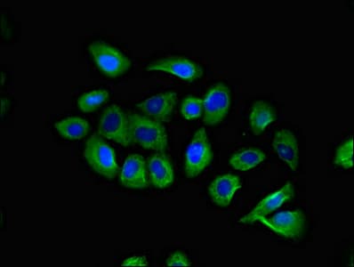 CCR10 / GPR2 Antibody