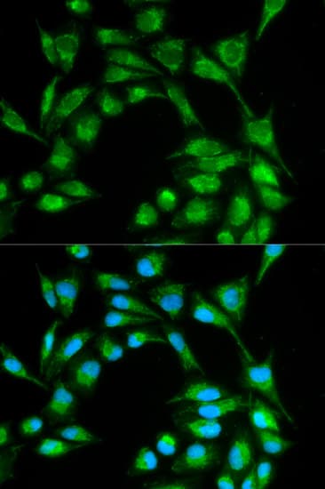 IHC-plus™ ICOS / CD278 Antibody