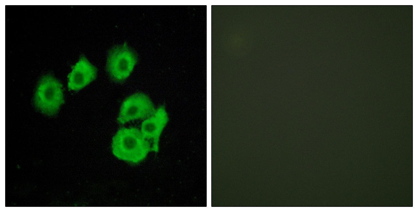 CYSLTR1 / CYSLT1 Antibody