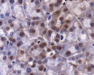 KDM4A / JHDM3A / JMJD2A Antibody (aa320-460)