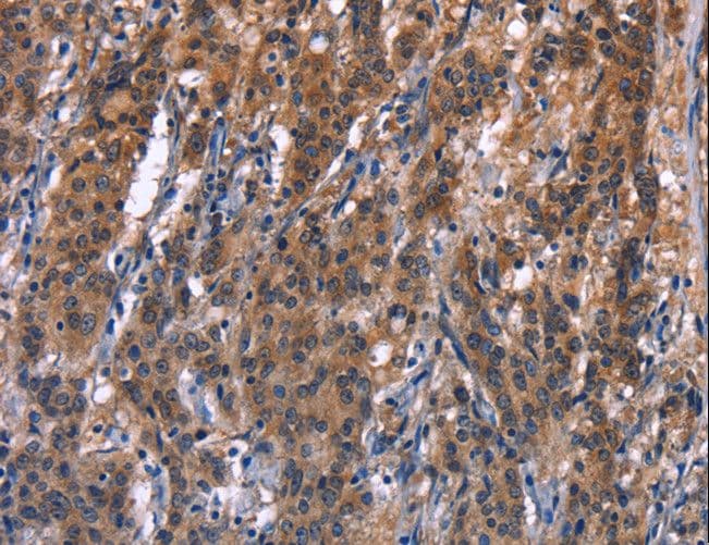 R3HCC1L / C10orf28 Antibody