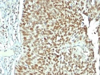 NCL / Nucleolin Antibody (clone NCL/902, Ready-to-Use)