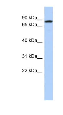LOC81691 Antibody (aa251-300)