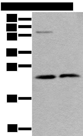 Polyclonal Rabbit anti-Human ABHD14B Antibody (IHC, WB)