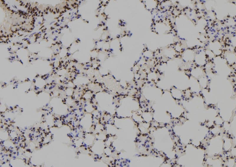 HOXB1 Antibody