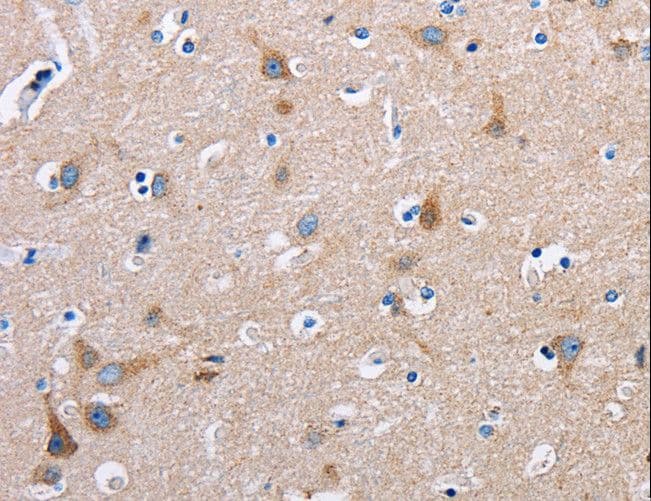 Polyclonal Rabbit anti-Human FN1 / Fibronectin Antibody (IHC)