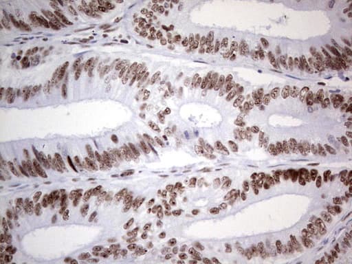 HDAC9 Antibody (aa181-460, clone OTI7G2, Carrier-free)