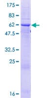 Human FCN2 / Ficolin-2 Protein (Recombinant GST)
