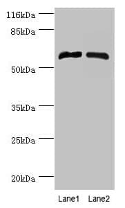 Polyclonal Rabbit anti-Human CYP4F11 Antibody (aa38-524, WB)