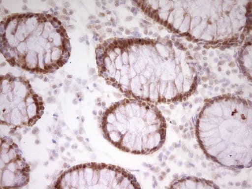Monoclonal Mouse anti-Human PAPSS2 Antibody (clone OTI3H10, aa1-247, IHC, WB)