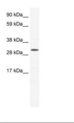 SOX12 Antibody (C-Terminus)