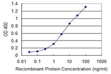 MAP3K7 / TAK1 Antibody (clone 3C9)