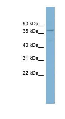 CNOT4 / CLONE243 Antibody (aa539-588)