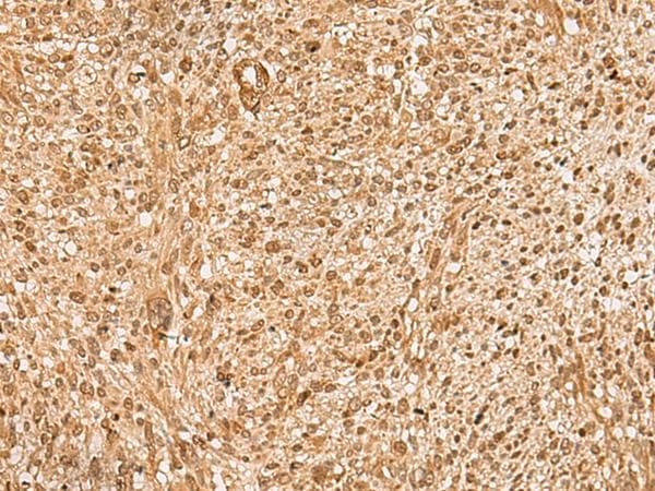 HIRIP3 Antibody