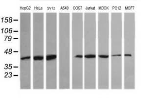 MAPK13 / p38delta Antibody (clone OTI2G6)
