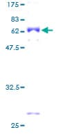 Human CCBL1 Protein (Recombinant GST)