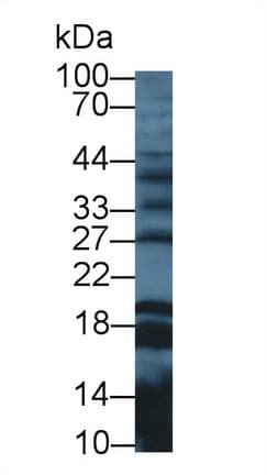 GAL / Galanin Antibody (aa32-122)