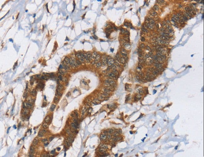 RPS6KA2 / RSK3 Antibody
