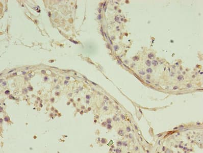 GIF / Intrinsic Factor Antibody (aa19-417)