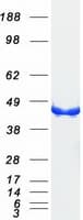 Human CKB / Creatine Kinase BB Protein (Recombinant Myc-DDK (Flag))