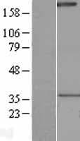 NALP1 / NLRP1 Protein (Over-Expression Lysate Myc-DDK (Flag))