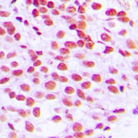 Polyclonal Rabbit anti-Human ELK1 Antibody (N-Terminus, IHC, IF, WB)