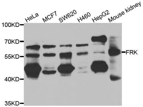 Polyclonal Rabbit anti-Human FRK Antibody (IHC, IF, WB)