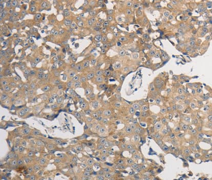 PP2CB / PPP2CB Antibody