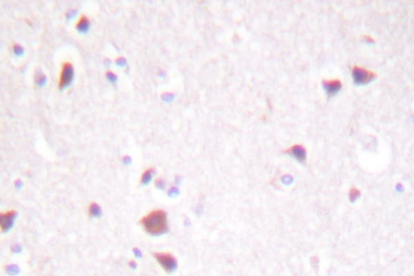 MST1 + MST2 Antibody (Met178)