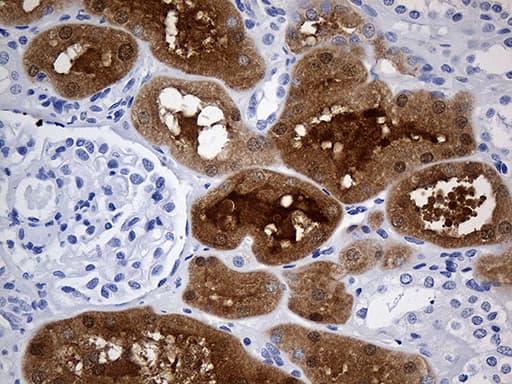 GALM / Mutarotase Antibody (clone OTI2F8)