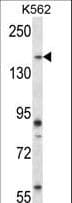 PEAK1 / SGK269 Antibody (aa1188-1216)