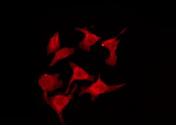 HTR2B / 5-HT2B Receptor Antibody
