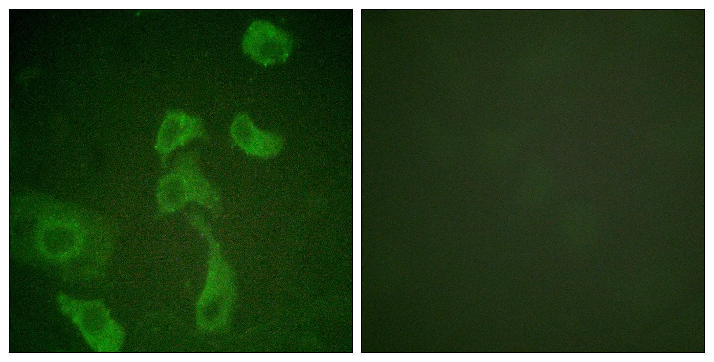 NCF1 / p47phox / p47 phox Antibody (p304)