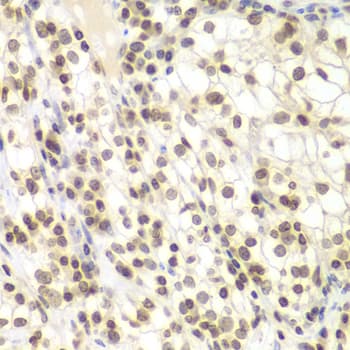 Polyclonal Rabbit anti-Human NIRF / UHRF2 Antibody (IHC, IF, WB)