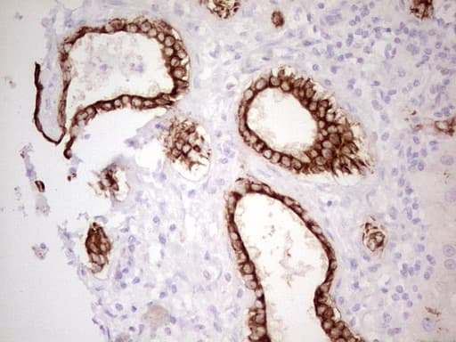 ABCB1 / MDR1 / P Glycoprotein Antibody (aa995-1280, clone OTI10H3, Carrier-free)