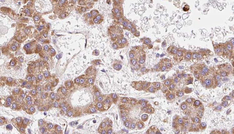 OR2B3 Antibody