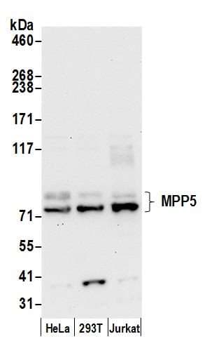 MPP5 Antibody (aa600-650)
