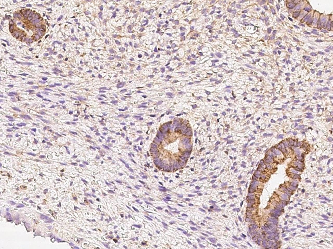 SLC39A6 / LIV-1 Antibody