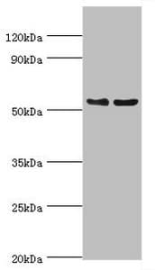 Polyclonal Rabbit anti-Human TFEB Antibody (aa1-220, IHC, WB)