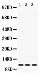 Polyclonal Rabbit anti-Human RPS27 / Ribosomal Protein S27 Antibody (IHC, WB)