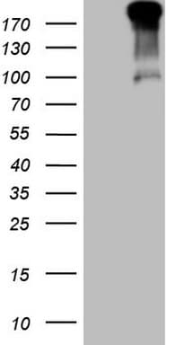 TP53BP1 / 53BP1 Antibody (aa1-300, clone OTI2H6)
