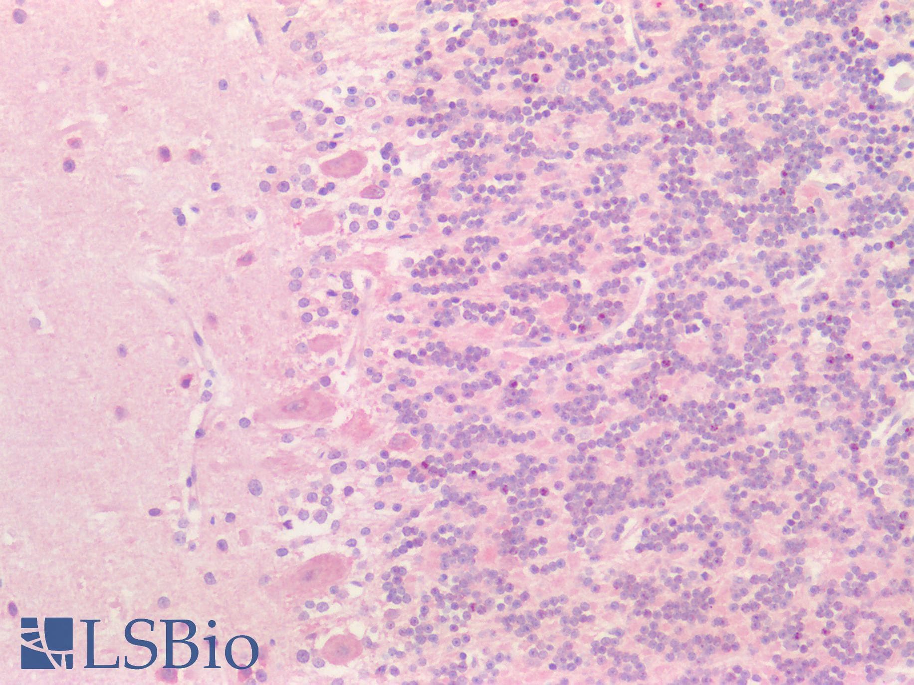 PathPlus™ Polyclonal Rabbit anti-Human SMC1A / SMC1 Antibody (aa1-248, IHC, WB)